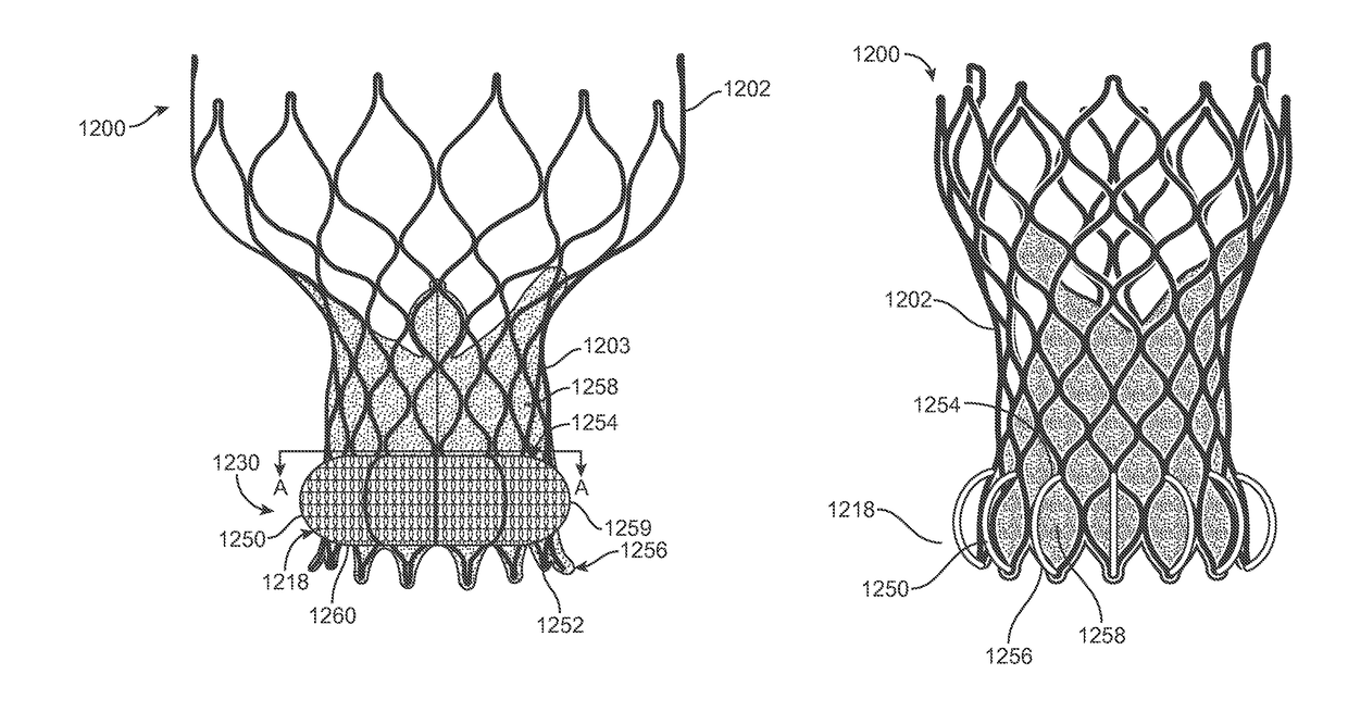 Anti-paravalvular leakage component for a transcatheter valve prosthesis