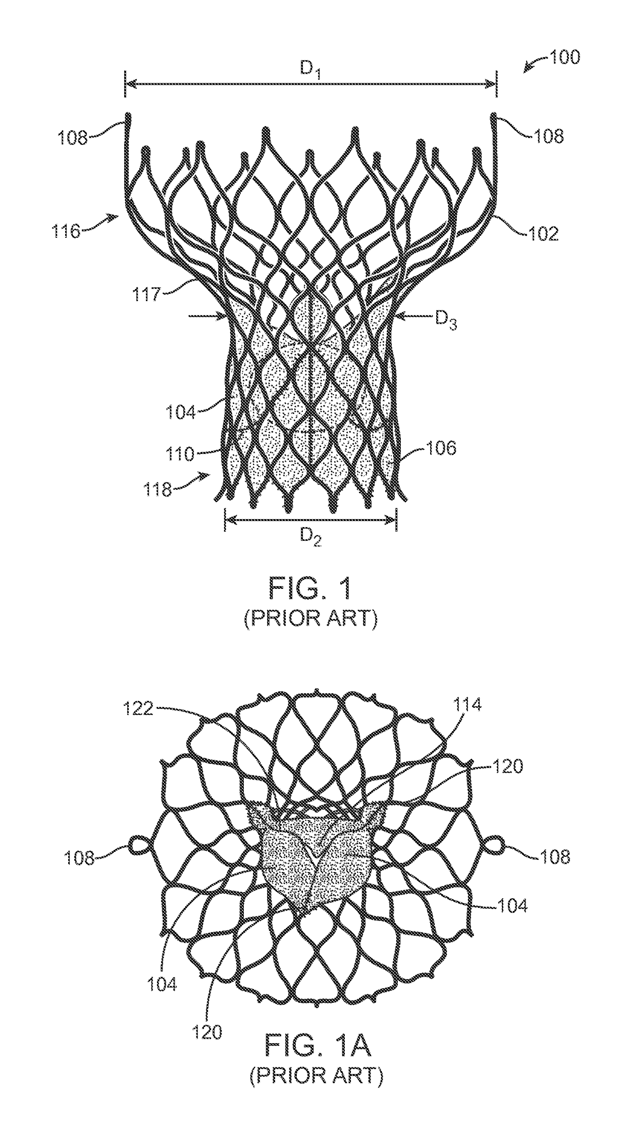 Anti-paravalvular leakage component for a transcatheter valve prosthesis