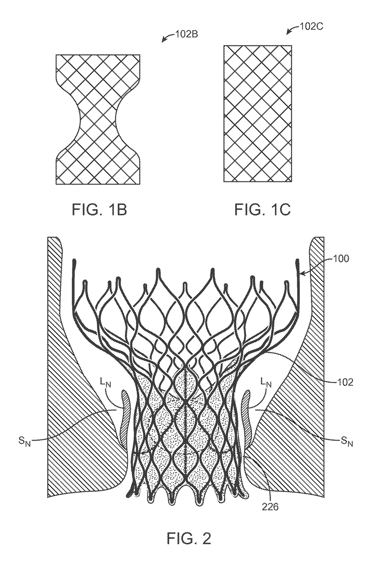 Anti-paravalvular leakage component for a transcatheter valve prosthesis