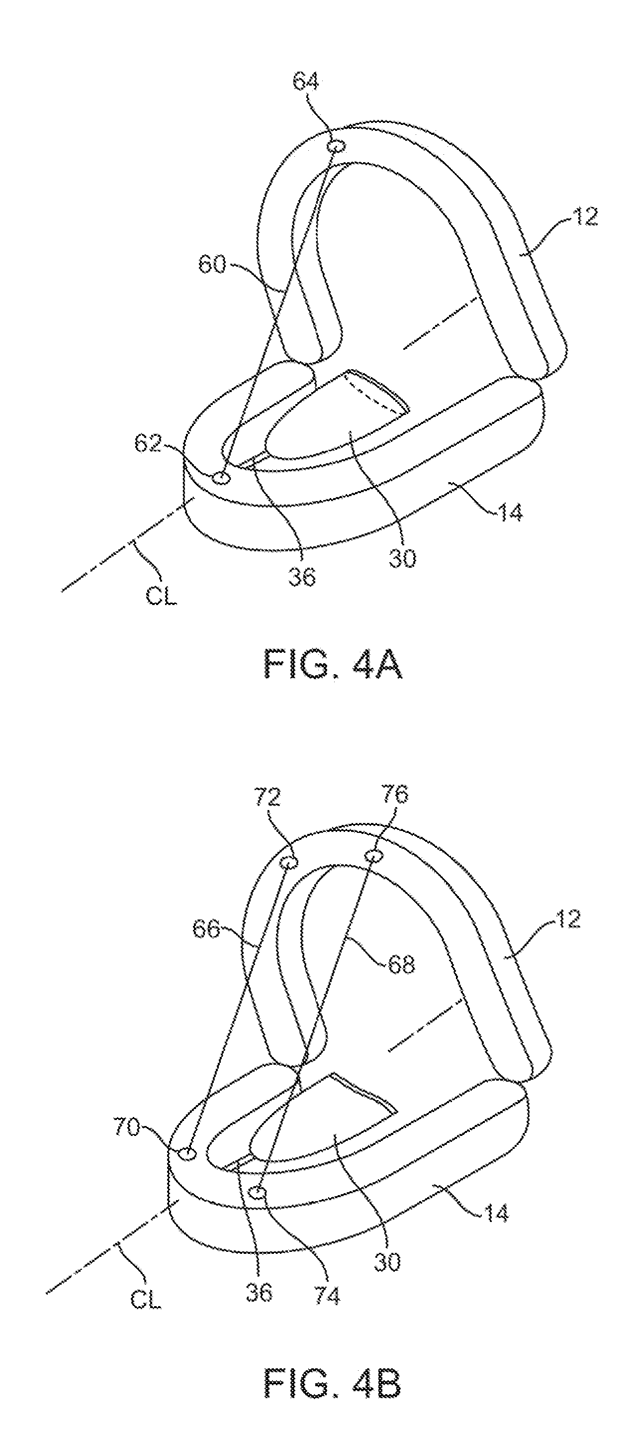 Wearable tissue retention device