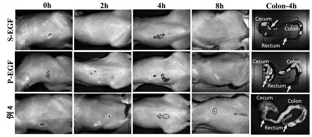 Temperature-sensitive gel for repairing colonic mucosa