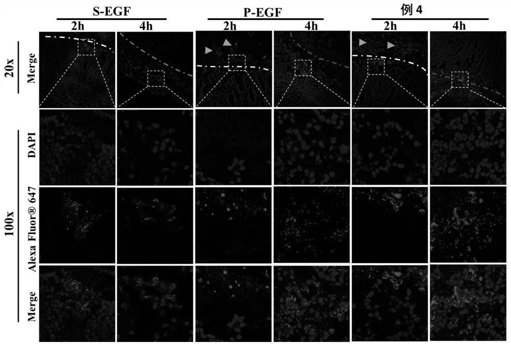 Temperature-sensitive gel for repairing colonic mucosa