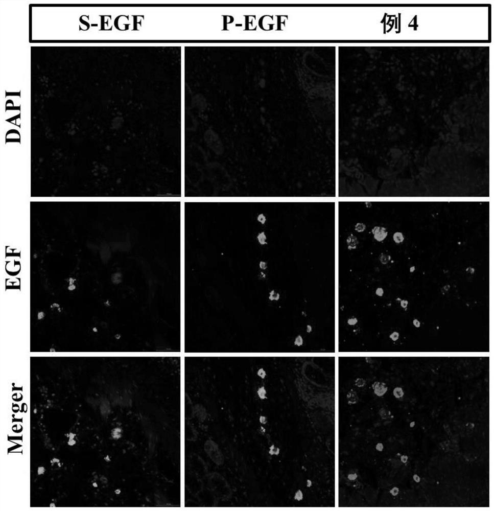 Temperature-sensitive gel for repairing colonic mucosa