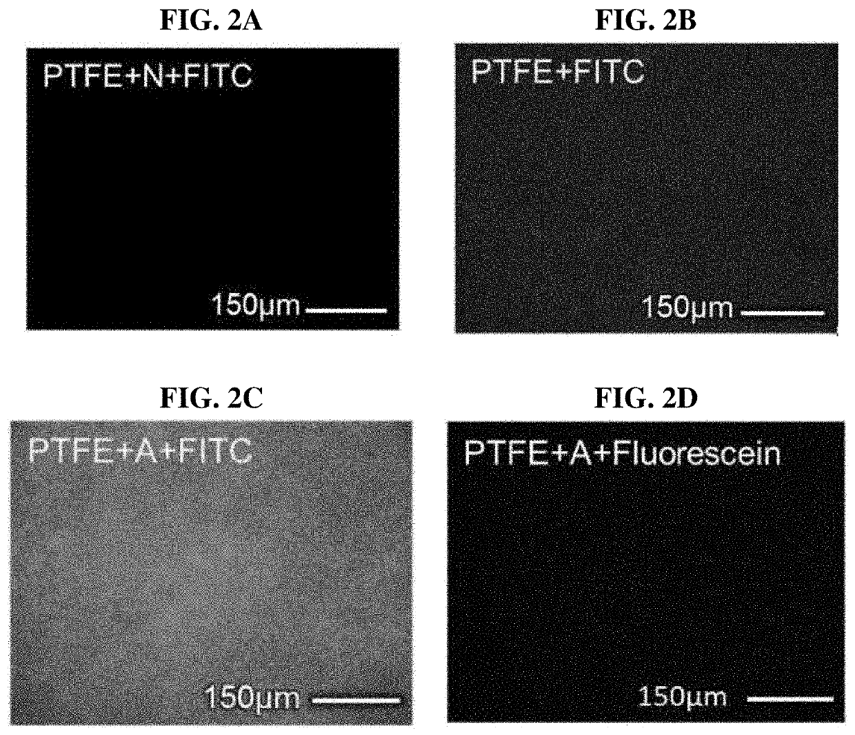 Parylene-a-coated insoluble porous membrane-based portable urea biosensor for use in flow conditions