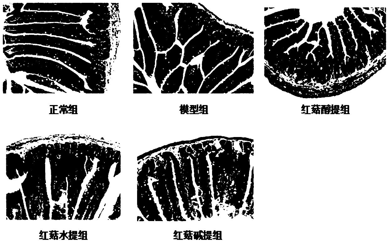 Application of red mushroom extracts in preparing preparation for treating and/ or preventing liver injury related diseases caused by high fat diet