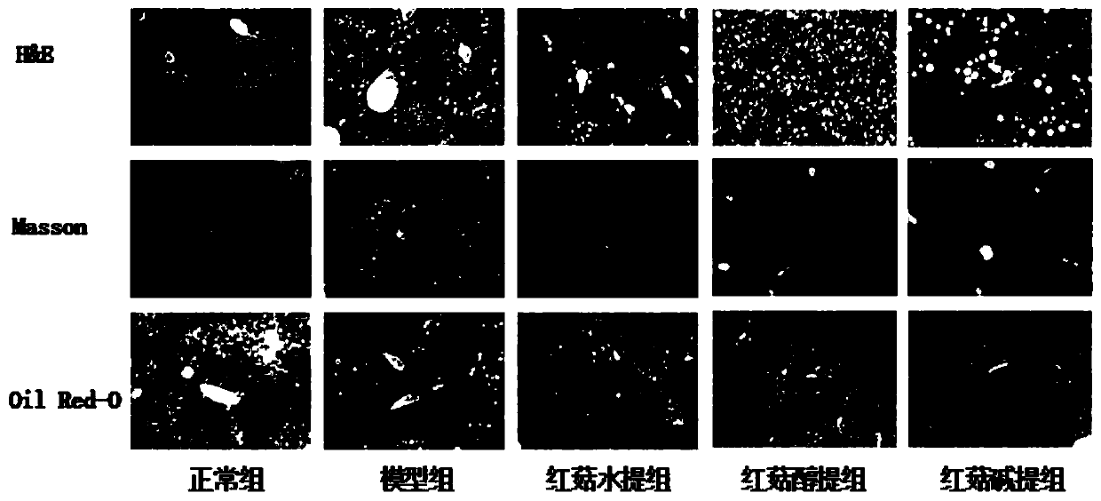 Application of red mushroom extracts in preparing preparation for treating and/ or preventing liver injury related diseases caused by high fat diet