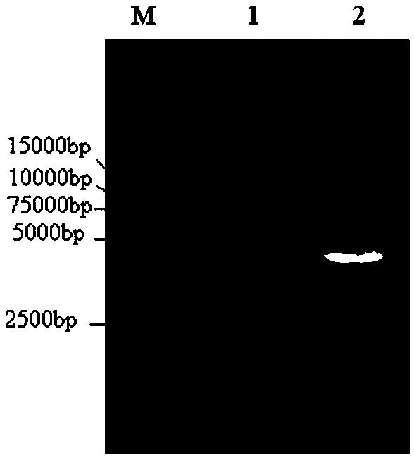 Genetic engineering acetic acid bacteria of overexpressing coenzyme PQQ (pyrroloquinoline quinone) synthetic proteins and application of bacteria