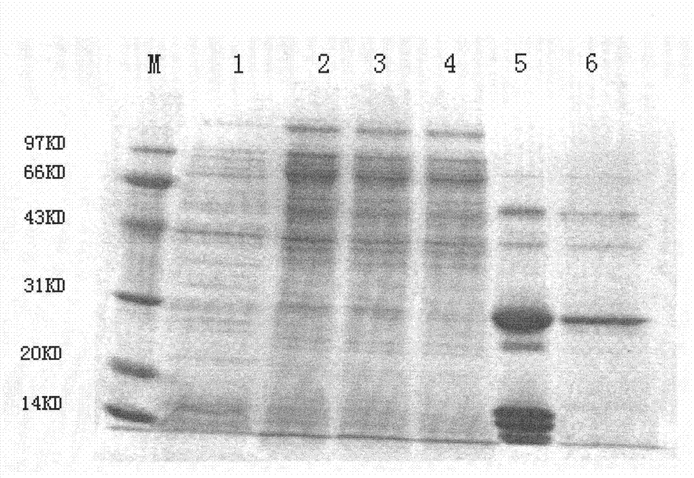 Human creatine kinase single-chain antibody with molecular chaperone function