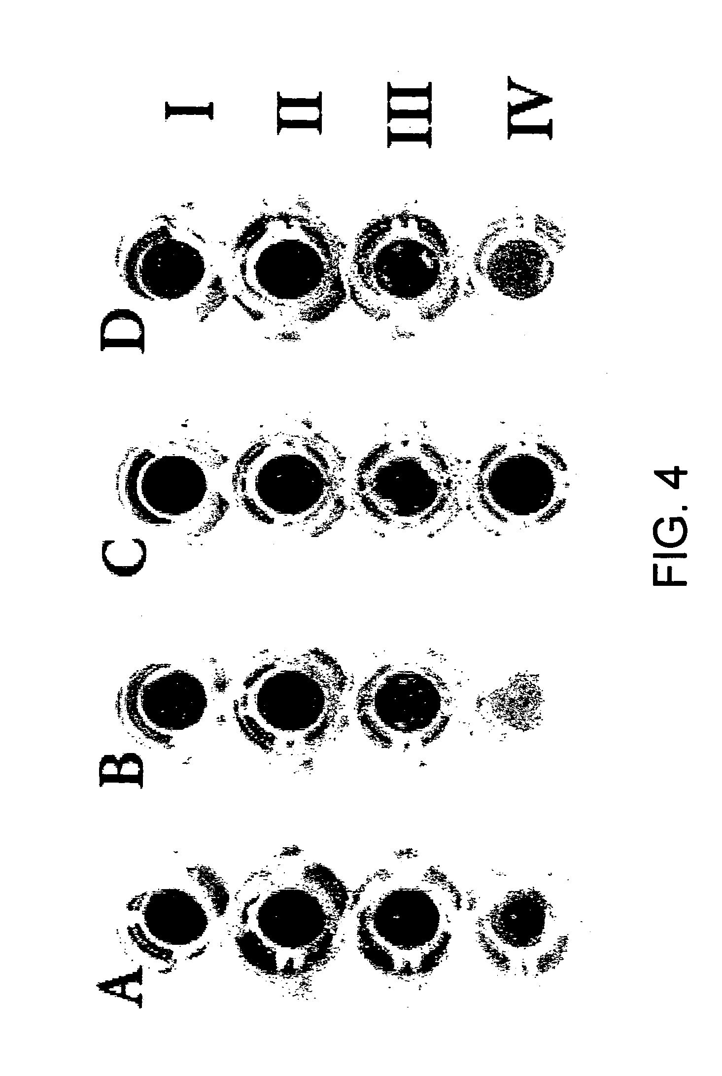 FTA-coated media for use as a molecular diagnostic tool