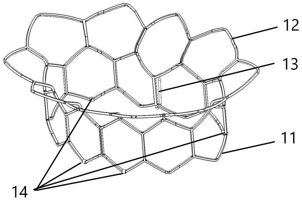 Split valve stent and interventional mitral valve replacement system comprising same