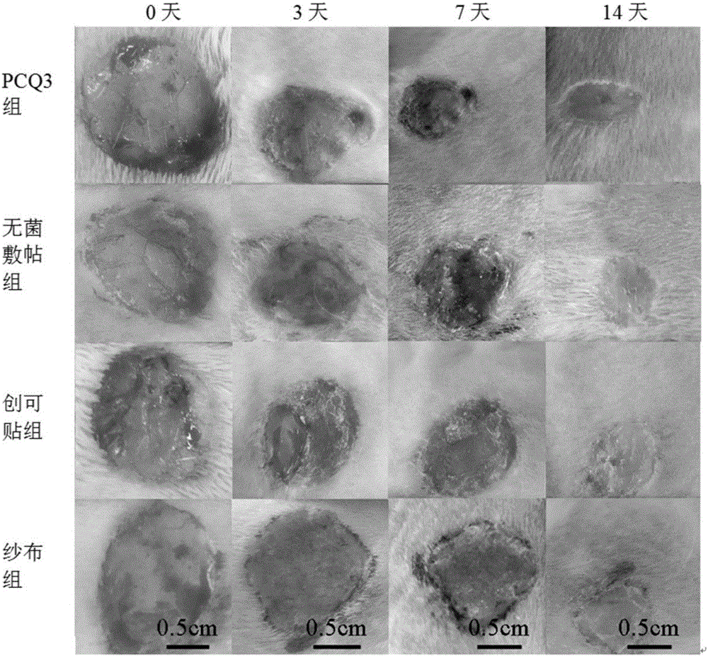 Polycaprolactone/collagen/quaternary ammonium salt electrospun composite fiber membrane and method for preparing same