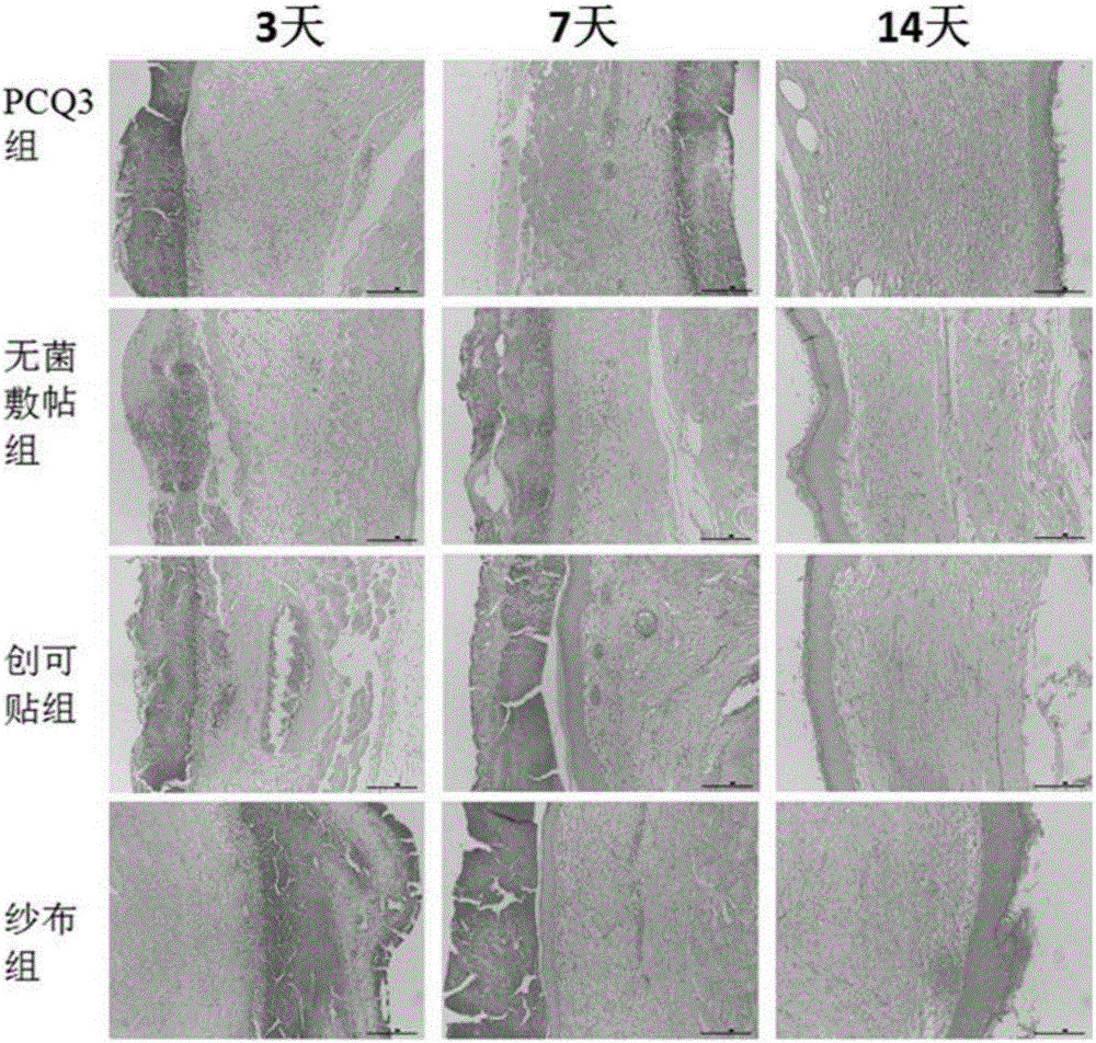 Polycaprolactone/collagen/quaternary ammonium salt electrospun composite fiber membrane and method for preparing same