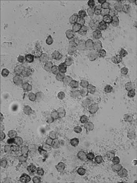 In-situ hybridization detection kit for microRNA-182 level in early stage of pathological evolution of various cancers, and detection method and application thereof