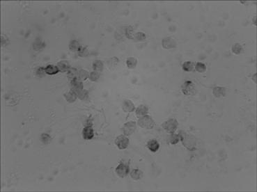 In-situ hybridization detection kit for microRNA-182 level in early stage of pathological evolution of various cancers, and detection method and application thereof