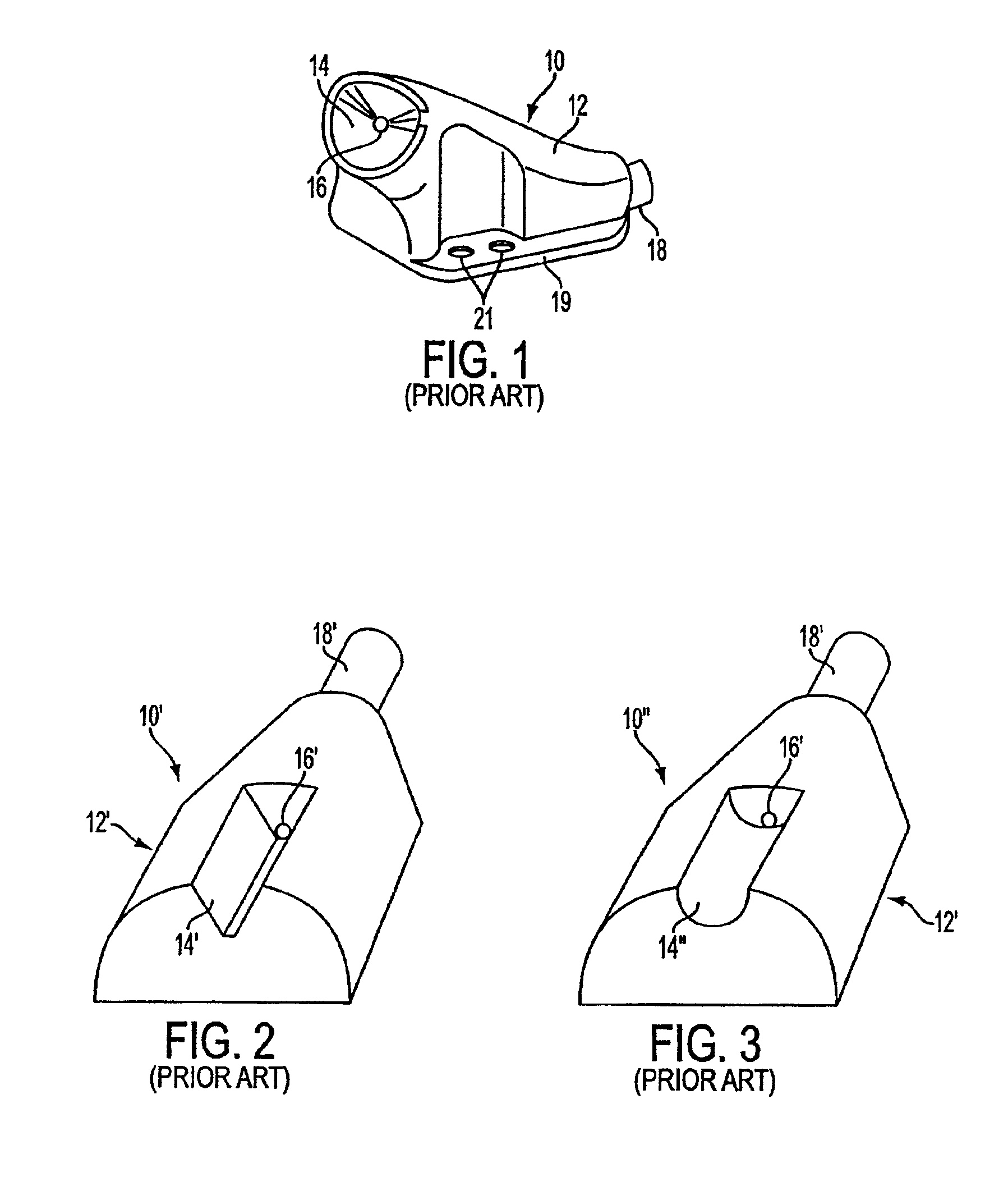 Subcutaneous access port