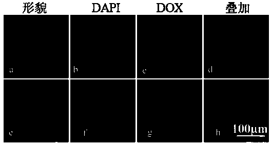 Gadolinium-doped monolayer hydrotalcite used for drug loading, preparation method thereof, anti-cancer drug and preparation method thereof