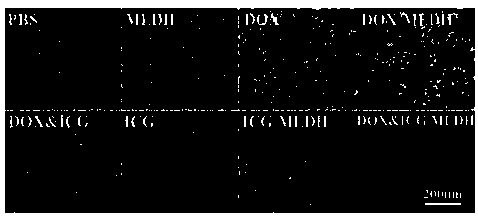 Gadolinium-doped monolayer hydrotalcite used for drug loading, preparation method thereof, anti-cancer drug and preparation method thereof