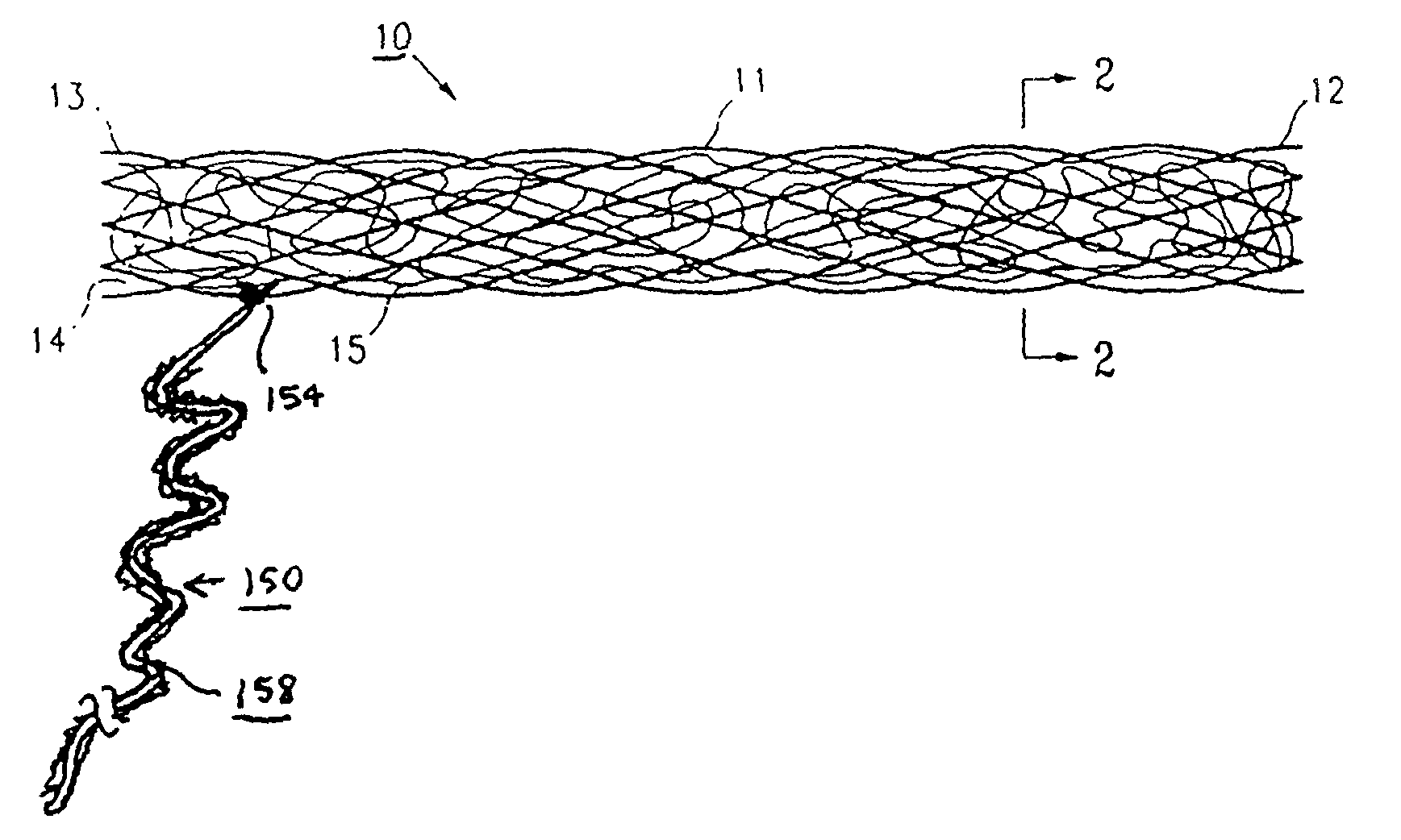 Methods and apparatus for occluding reproductive tracts to effect contraception