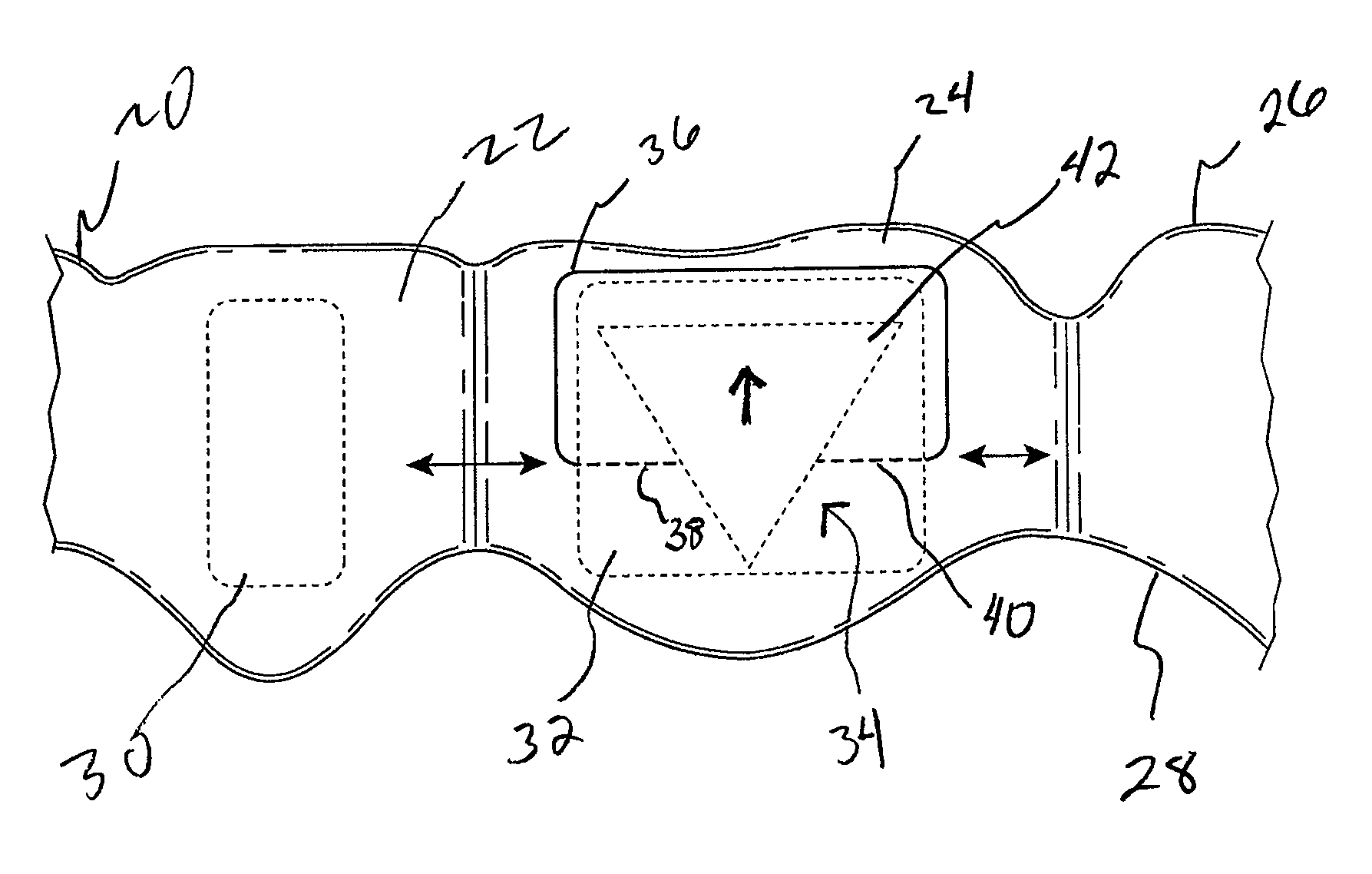 Orthodontic tooth movement device, systems and methods