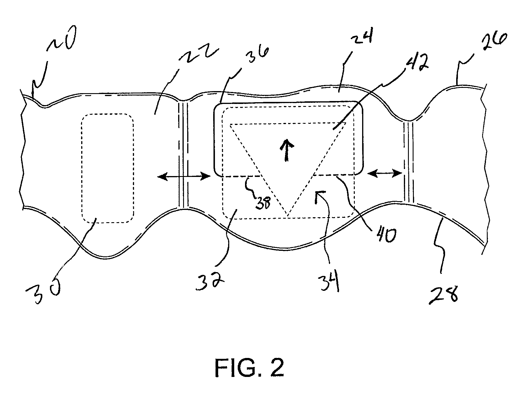 Orthodontic tooth movement device, systems and methods