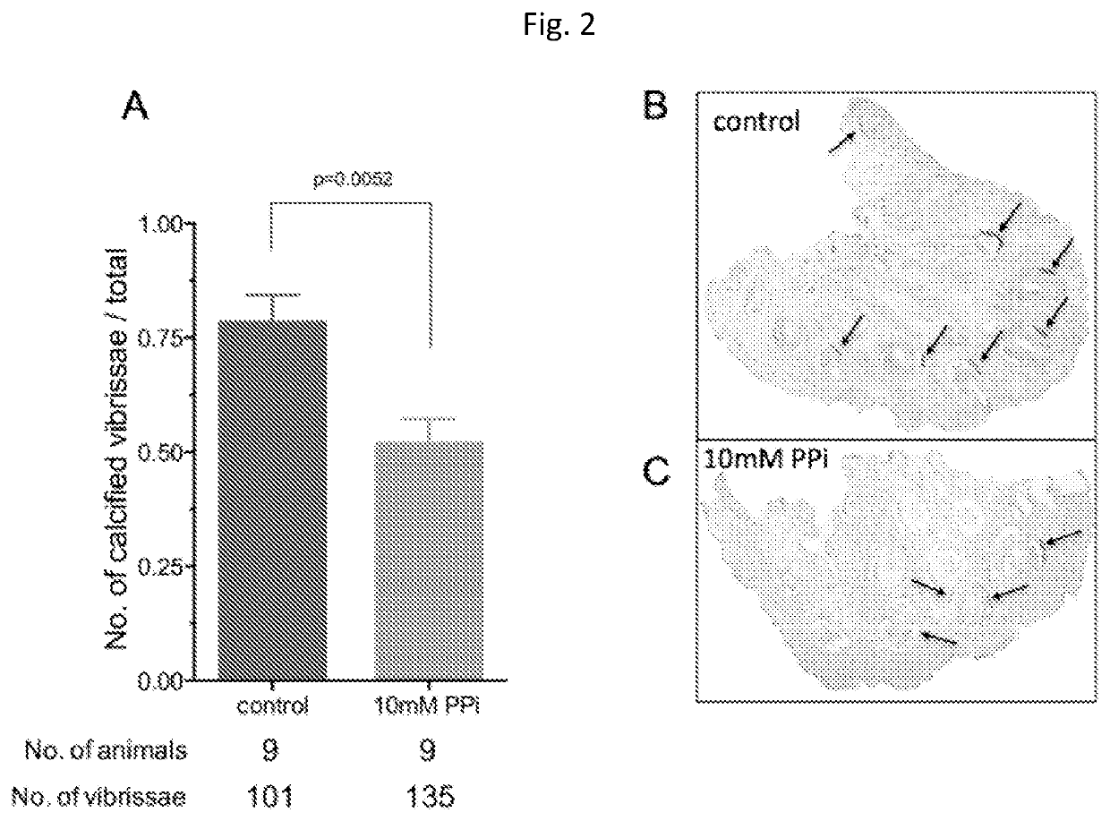 Oral pyrophosphate for use in reducing tissue calcification