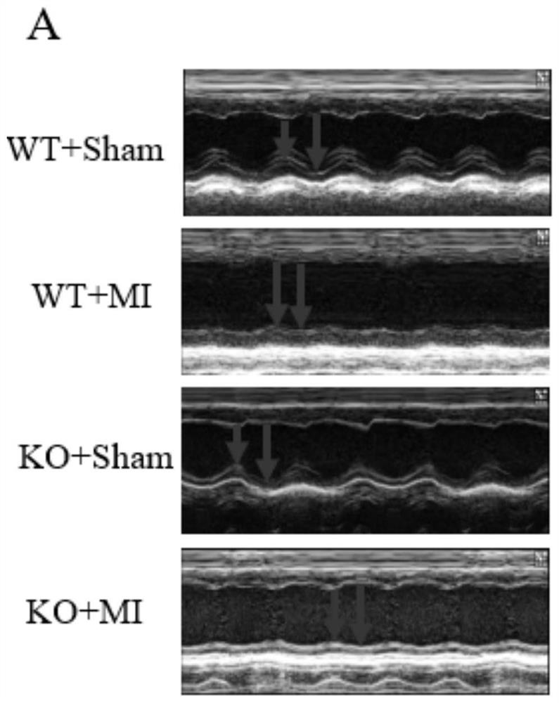 Application of RAB22A gene as target to preparation of myocardial infarction treatment product and related products