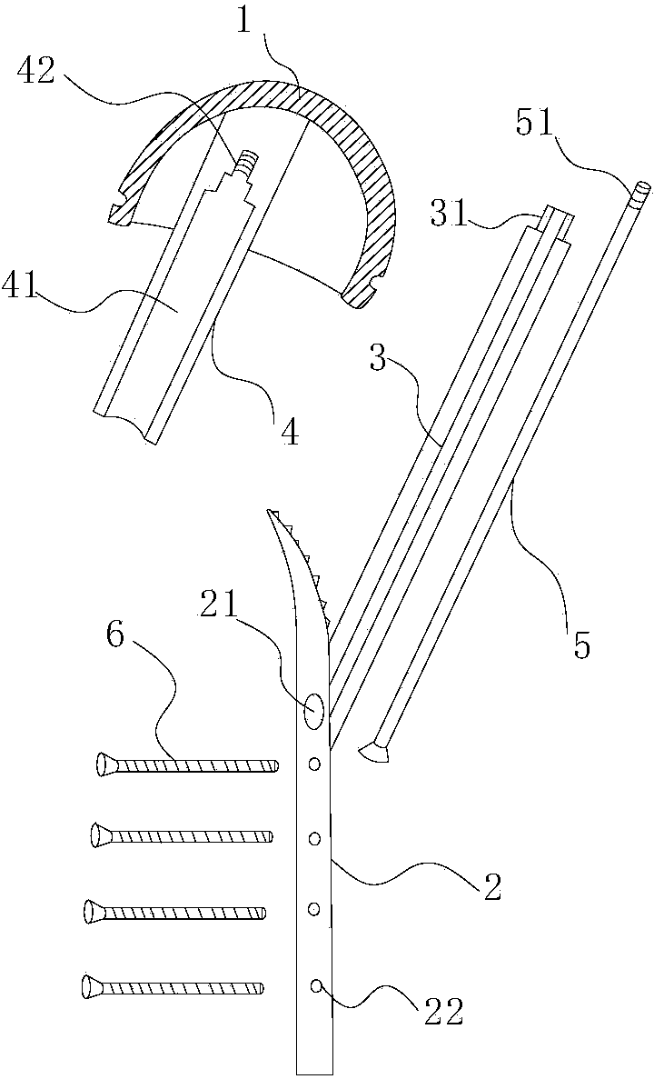 Biotype artificial hip joint surface replacement prostheses