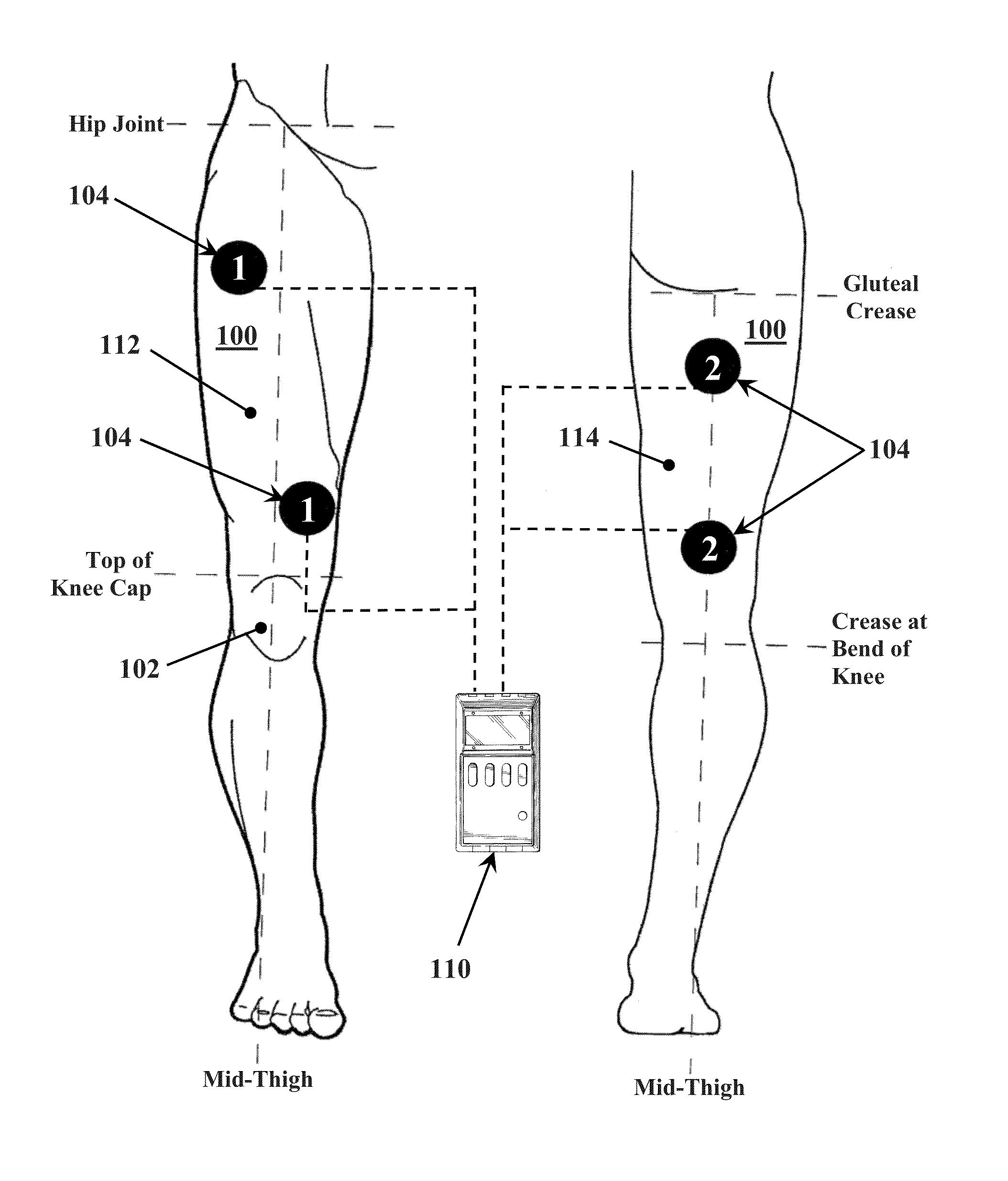 Methods for improving mobility and controlling cartilage matrix degradation of weight-bearing articular joints