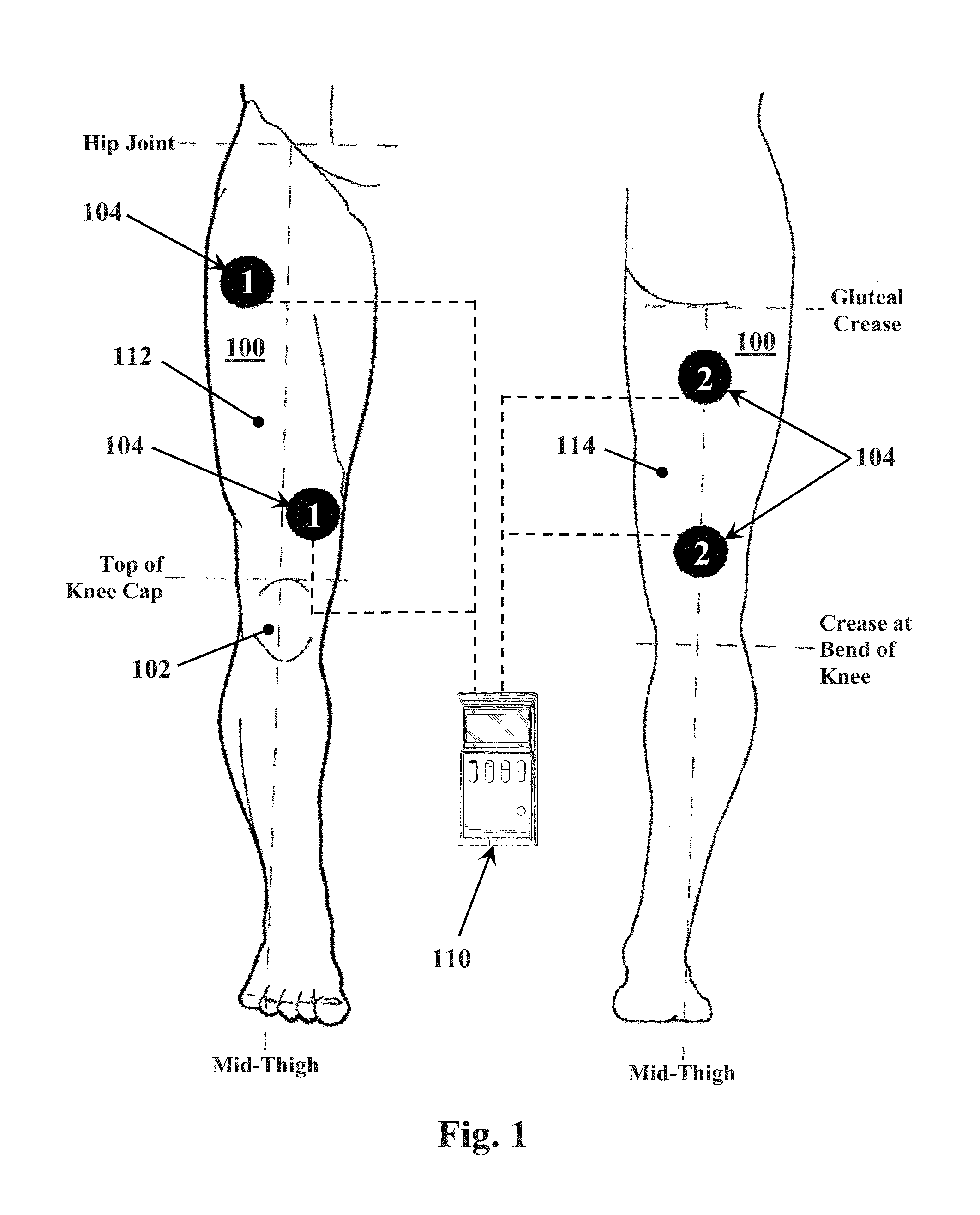 Methods for improving mobility and controlling cartilage matrix degradation of weight-bearing articular joints