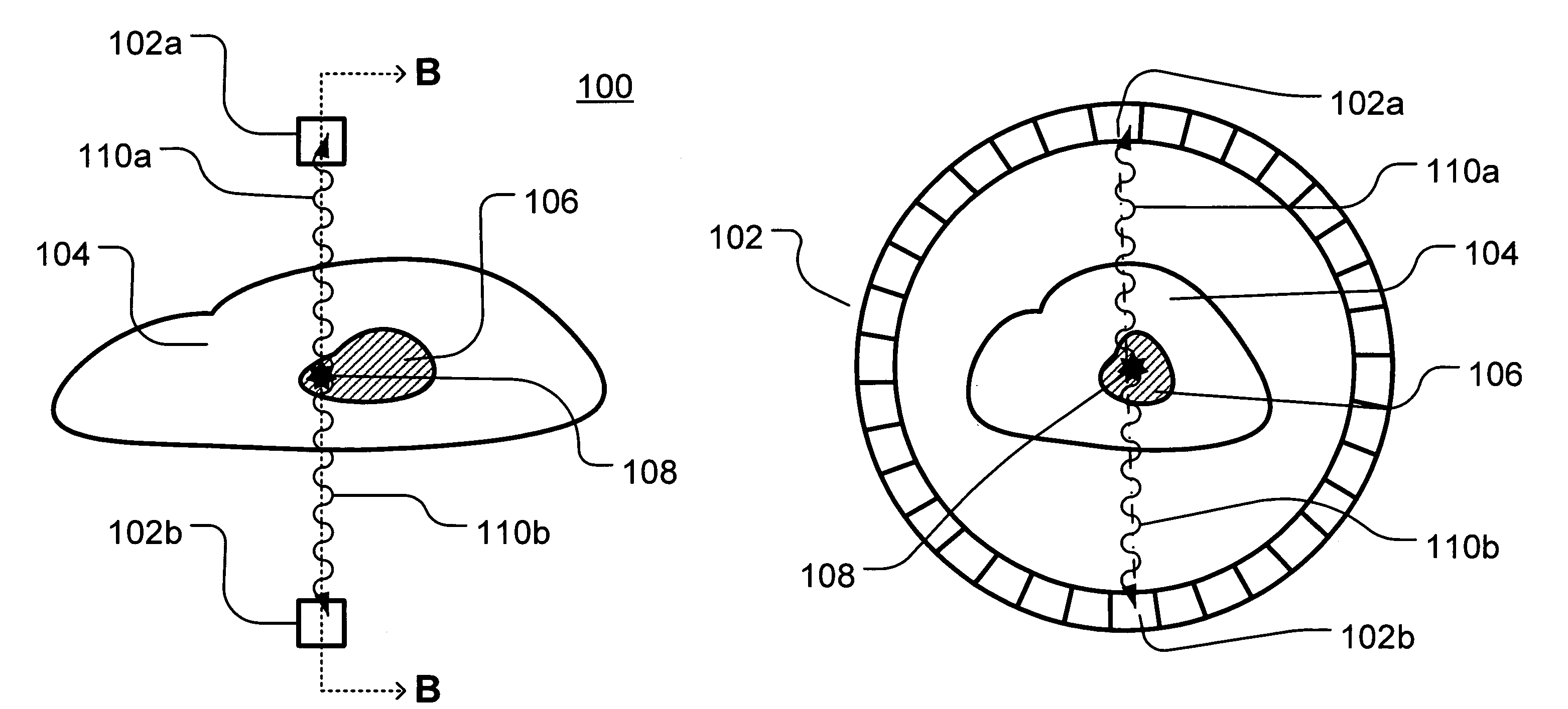 System for selecting true coincidence events in positron emission tomography