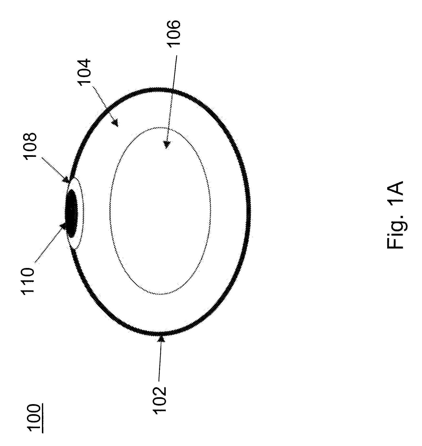 Method and apparatus for minimally invasive implants