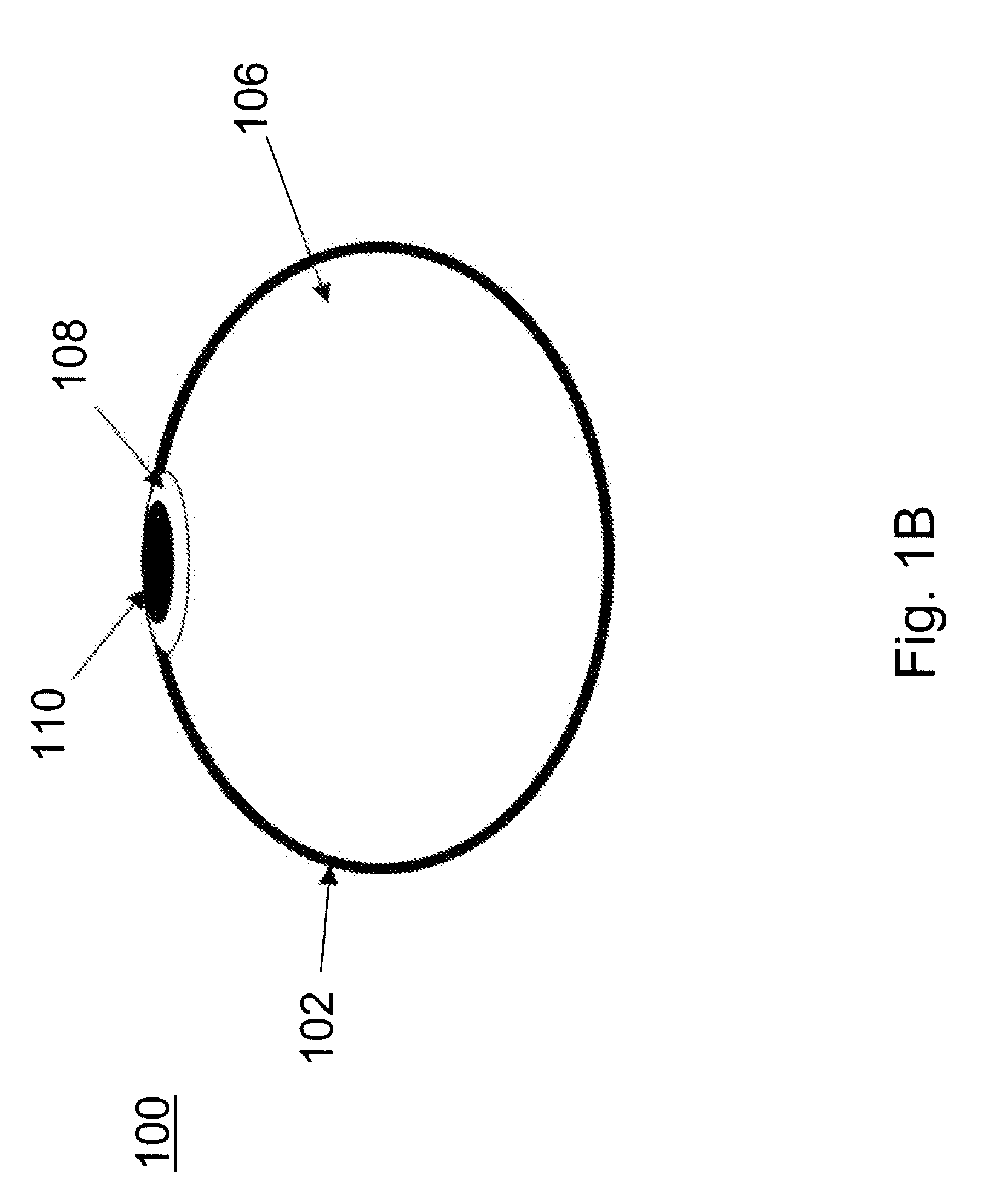 Method and apparatus for minimally invasive implants