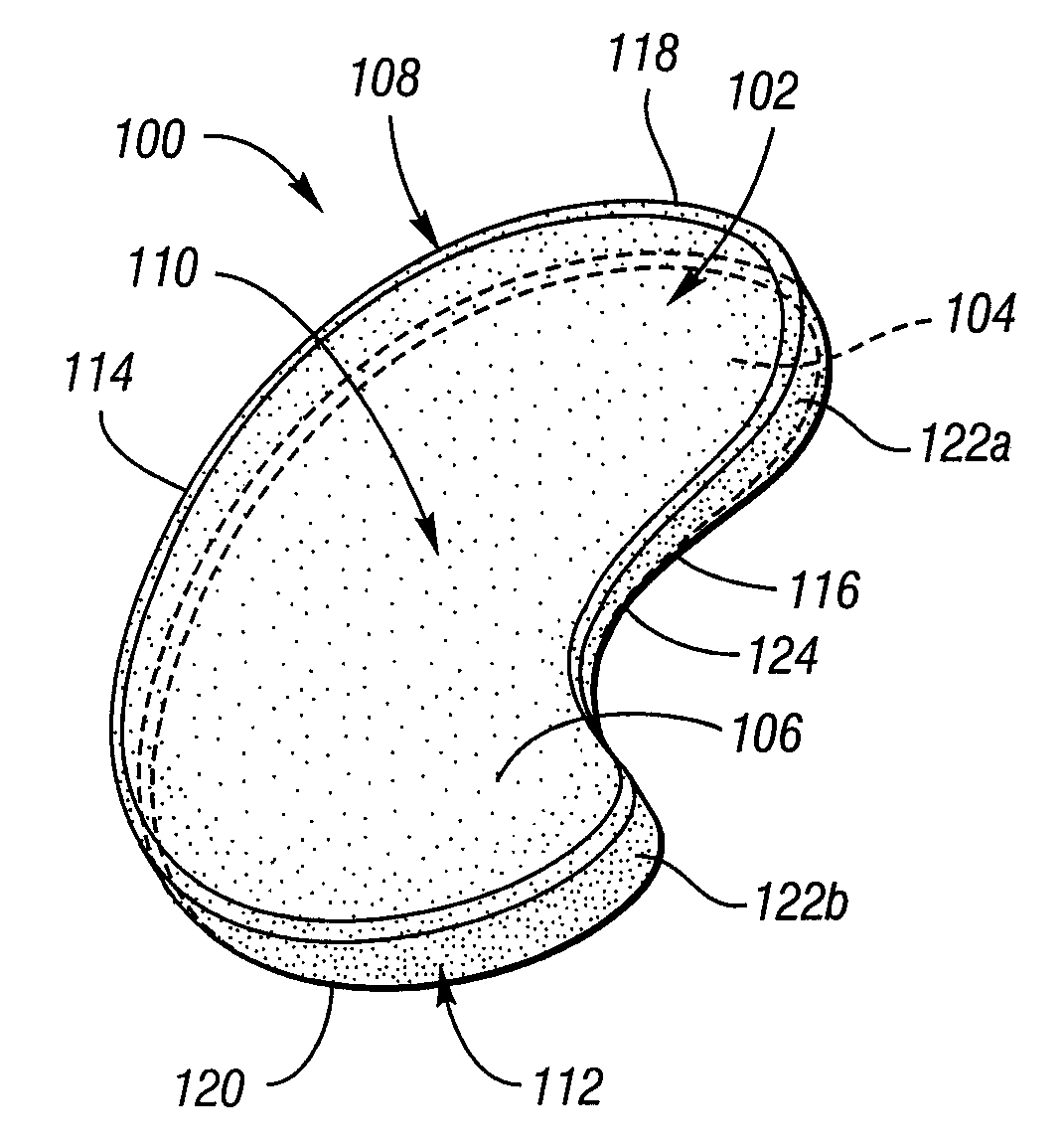 Surgically Implantable Knee Prosthesis