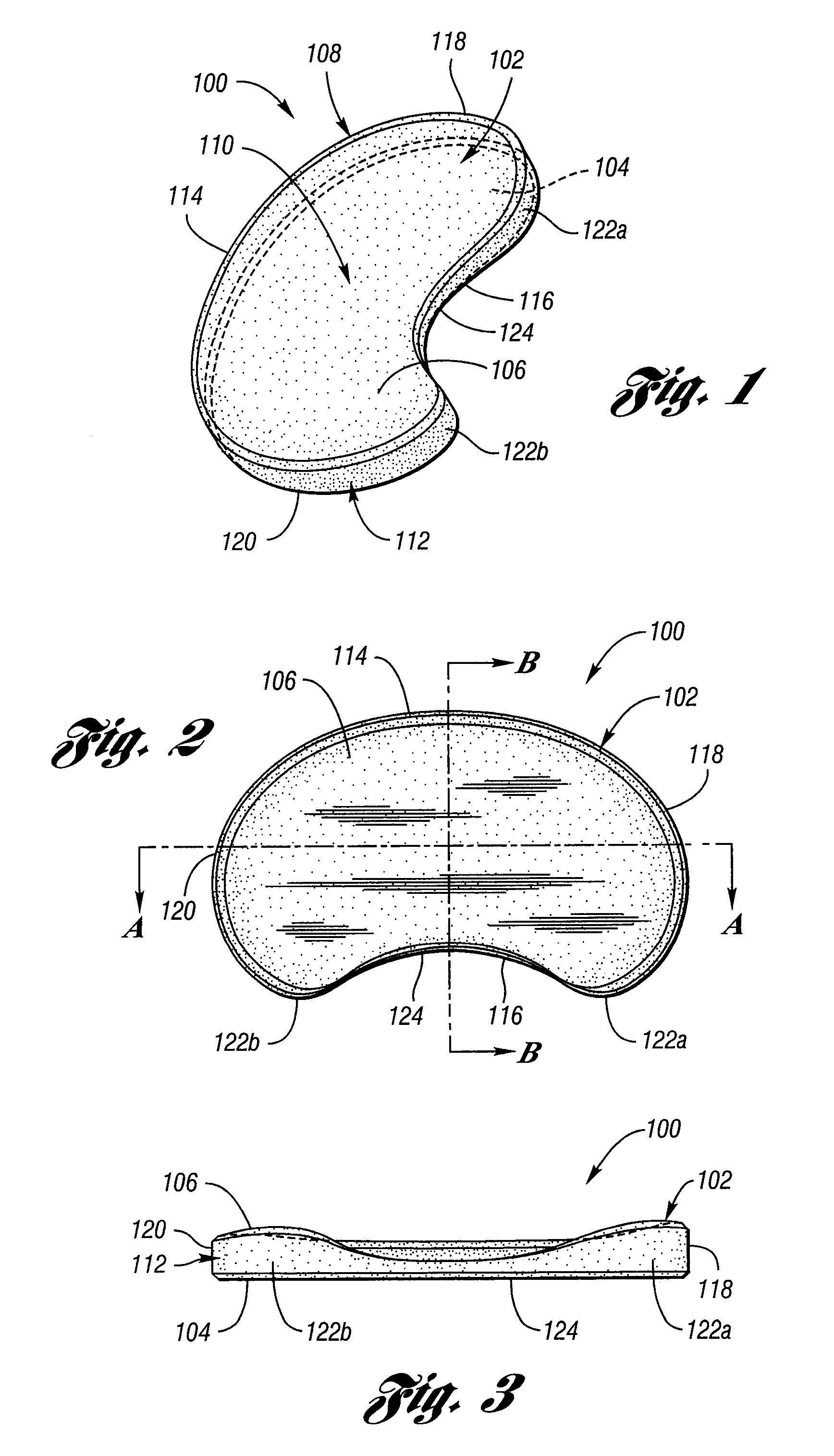 Surgically Implantable Knee Prosthesis