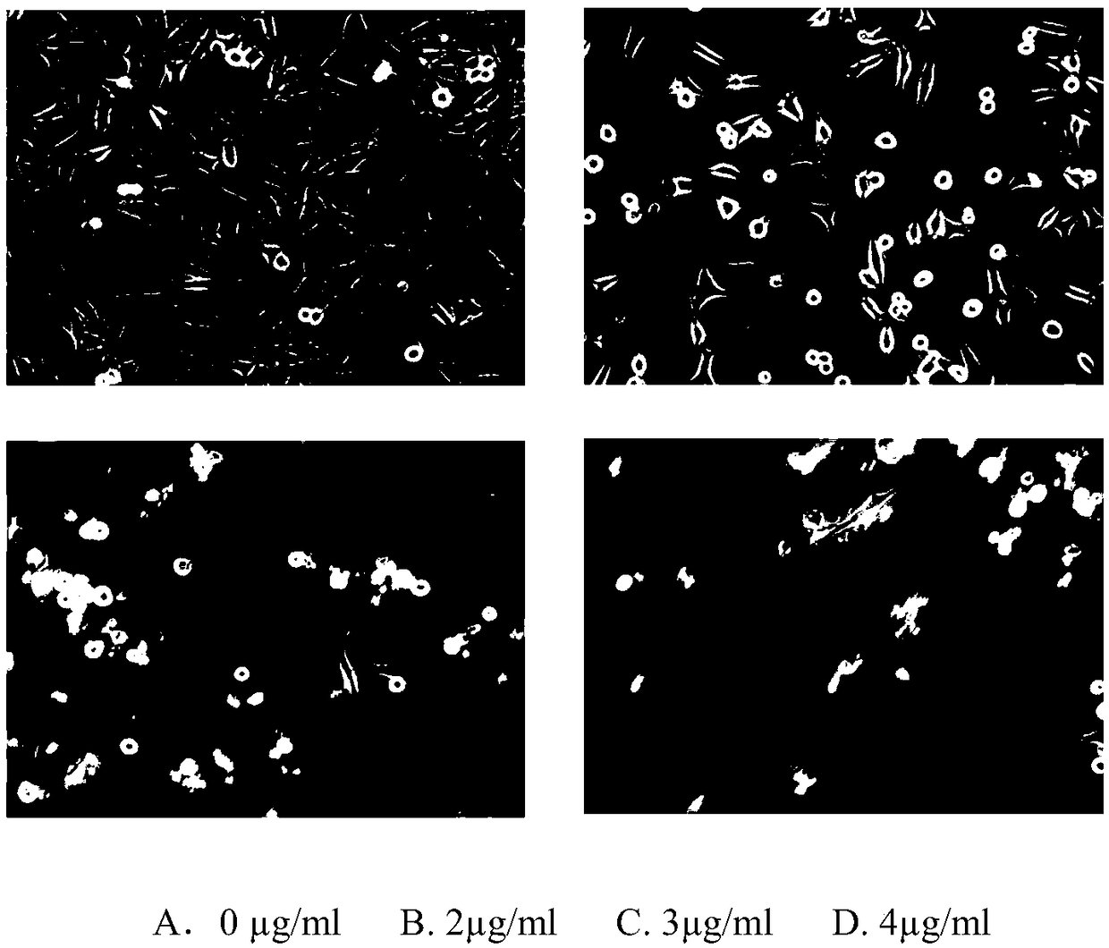 Pharmacodynamic application of schizocapsa plantaginea saponin in preparing drug for treating hepatic fibrosis