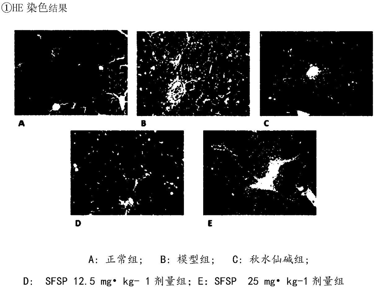 Pharmacodynamic application of schizocapsa plantaginea saponin in preparing drug for treating hepatic fibrosis