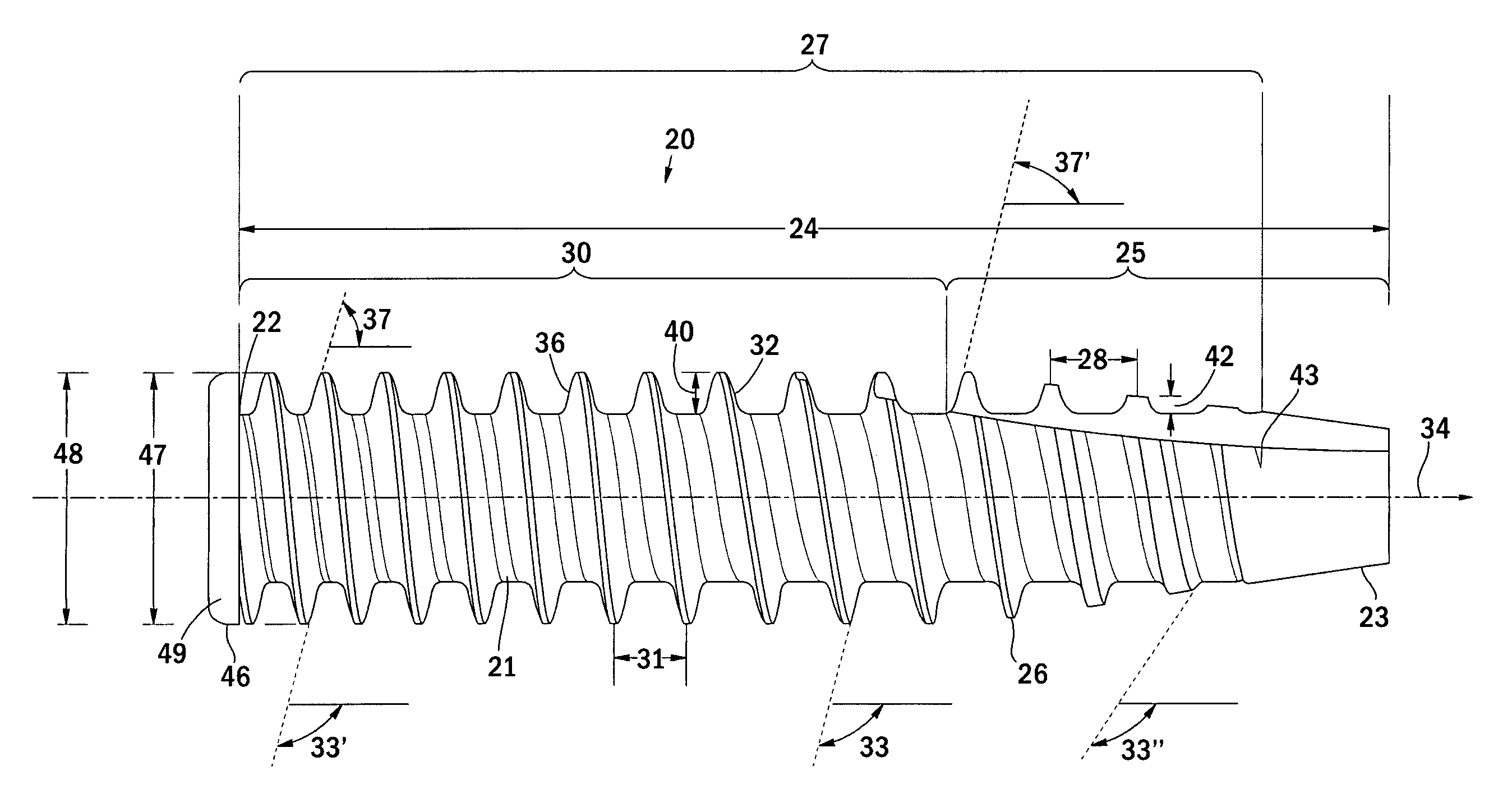 Orthopedic screw and method