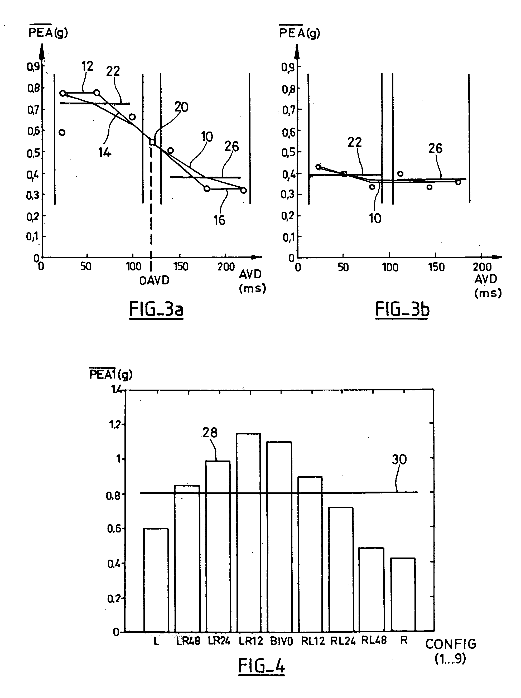 Device For Characterizing the Cardiac Status Of A Patient Equipped With A Biventricular Pacing Active Implant