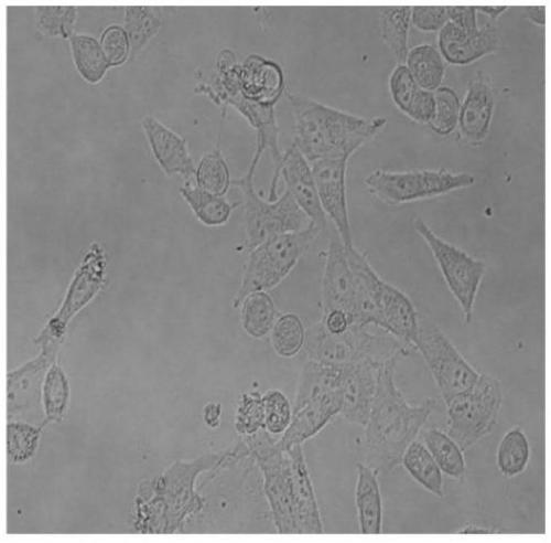 Tumor cell apoptotic bodies induced by CO2 shock method and anti-tumor application of tumor cell apoptotic bodies