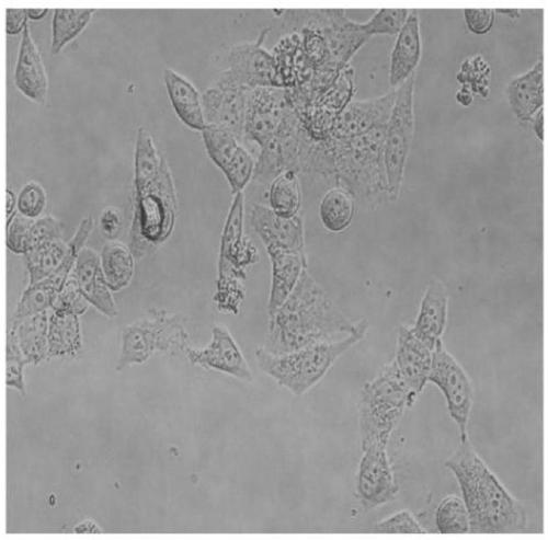 Tumor cell apoptotic bodies induced by CO2 shock method and anti-tumor application of tumor cell apoptotic bodies