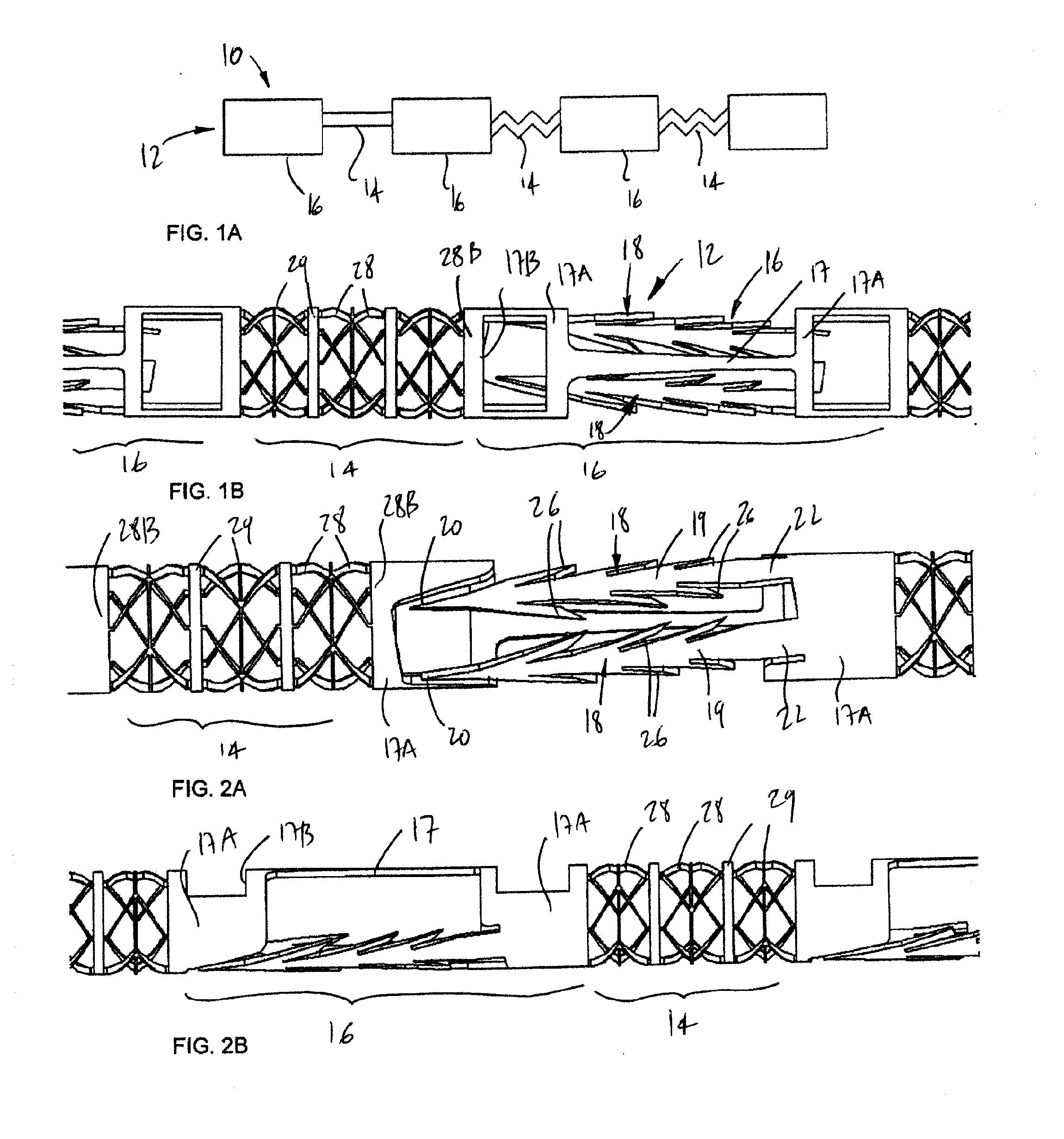 Device for soft tissue support and method for anchoring