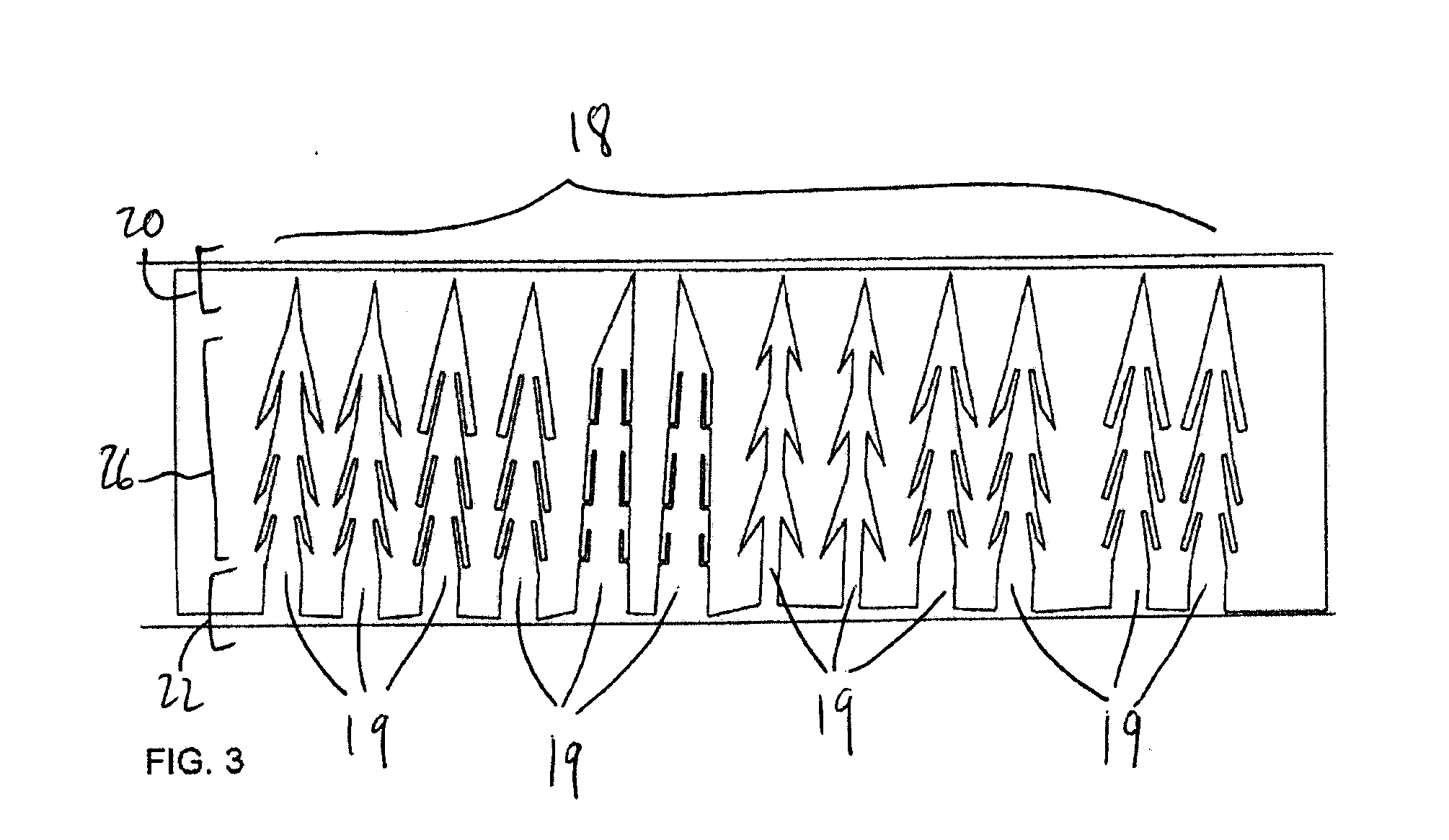 Device for soft tissue support and method for anchoring