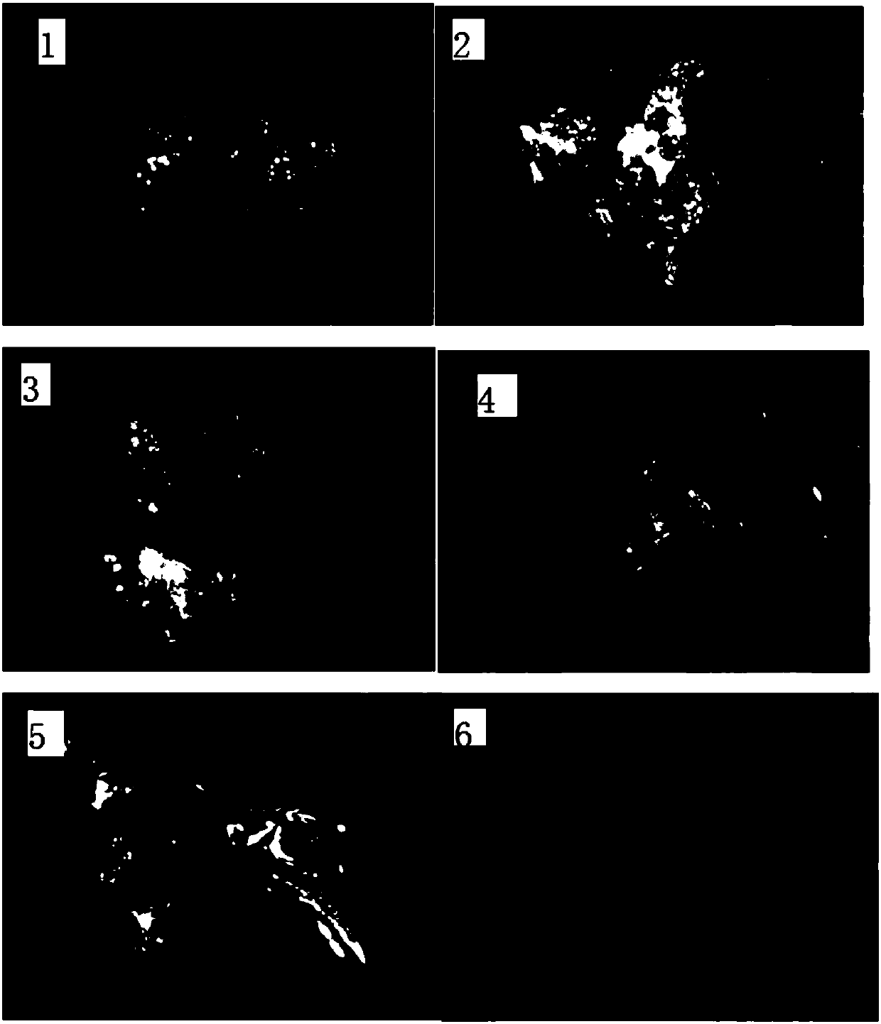 High-frequency somatic embryo regeneration culture medium without germplasm gene type limitation and application thereof