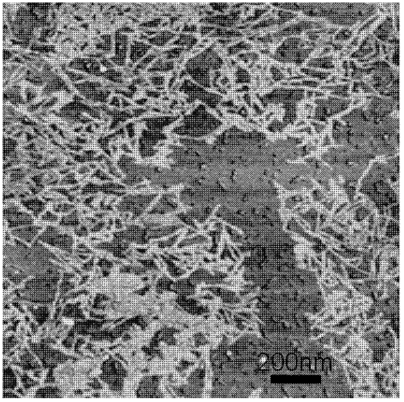 Preparation method for linear nanometre hydroxylapatite