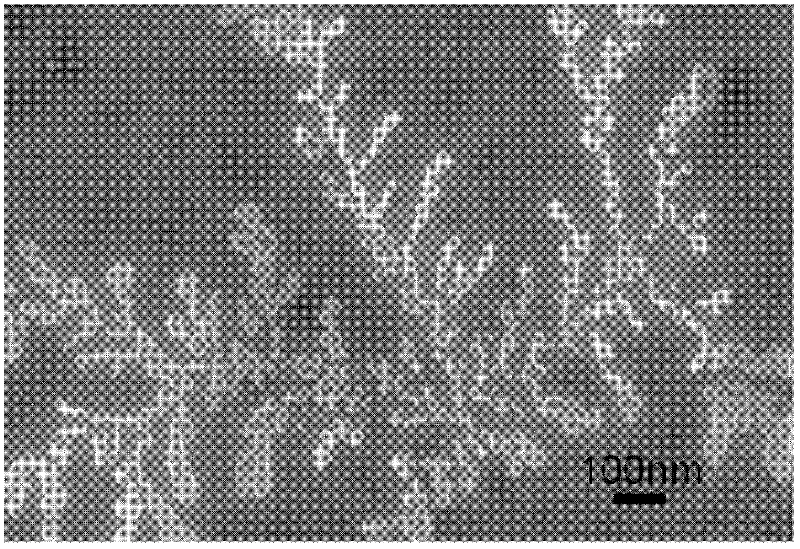 Preparation method for linear nanometre hydroxylapatite