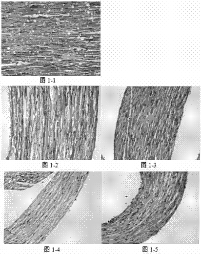 Application of hydrogen physiological saline in preparation for medicine treating acute neurological damage diseases