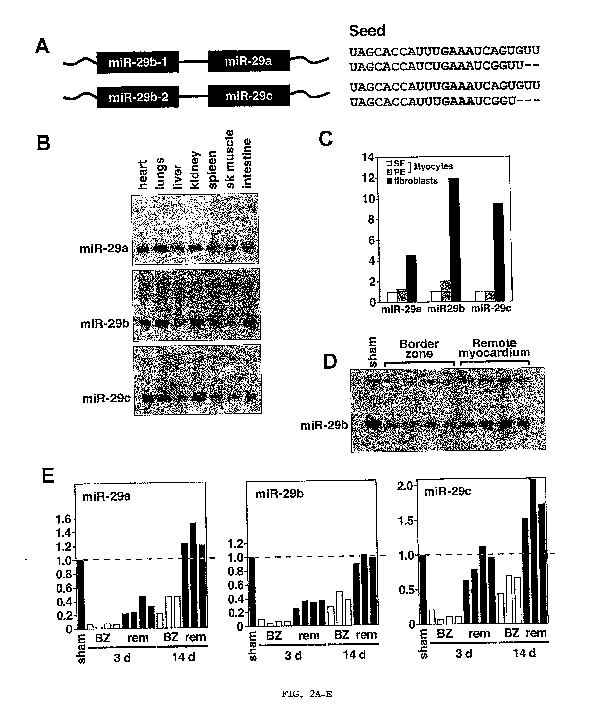 Identification of Micro-RNAS Involved in Post-Myocardial Infarction Remodeling and Heart Failure