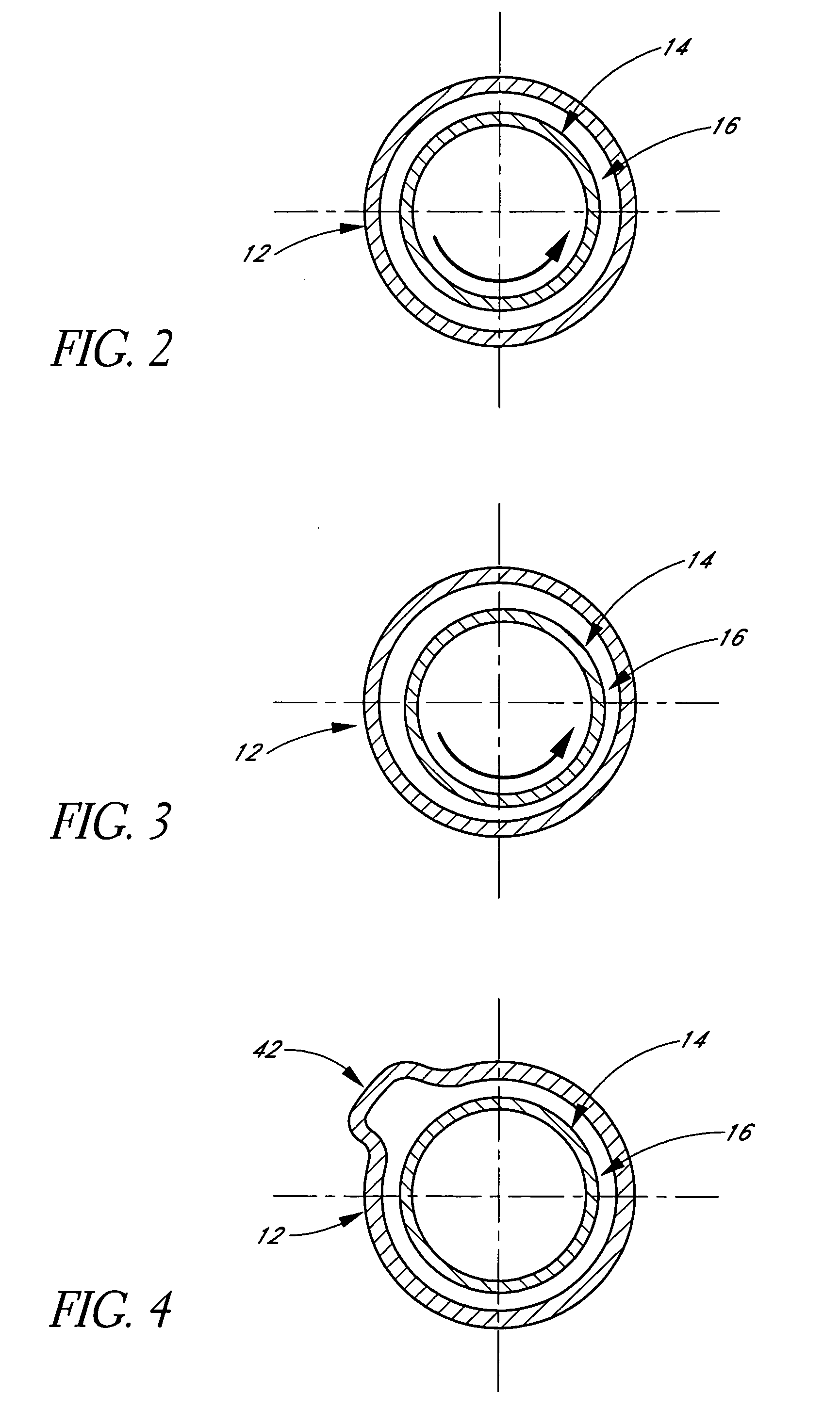 Two stage hemofiltration that generates replacement fluid