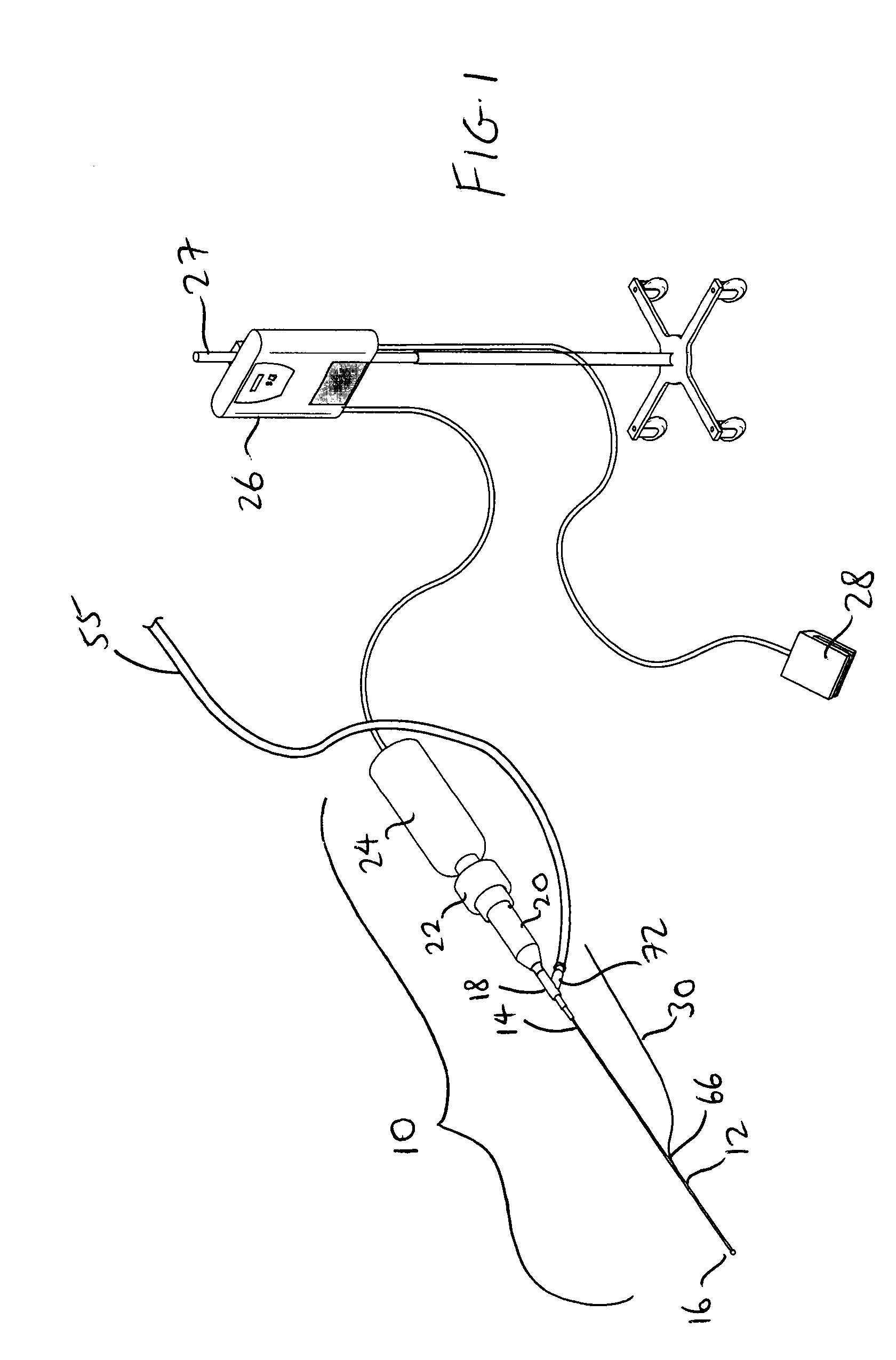 Therapeutic ultrasound system