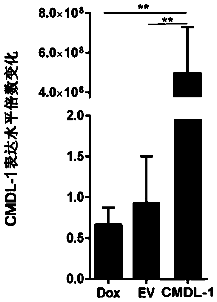 Application of CMDL-1, kit for diagnosis of heart disease and drug for treating heart disease